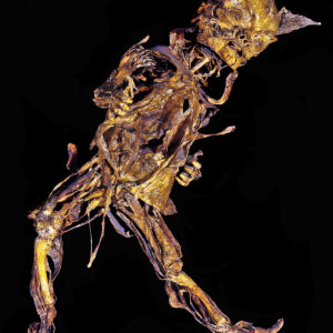 1fetus