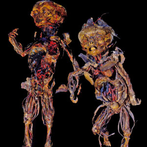 2fetus