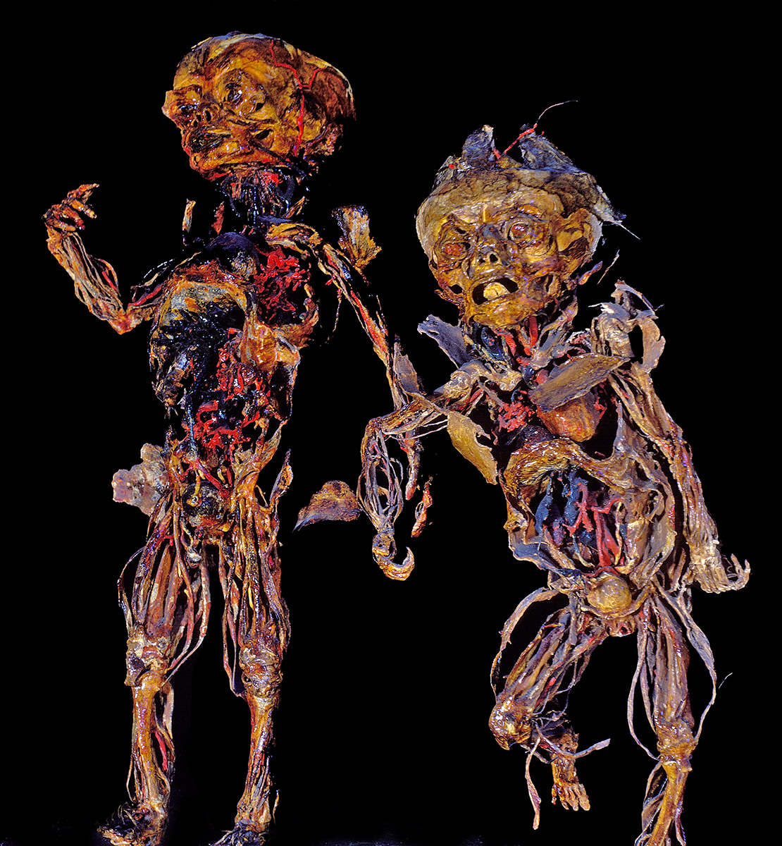 2fetus 2fetus